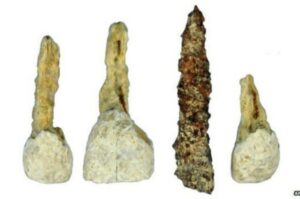 Sejarah Implan Gigi: Dari Masa Ke Masa, Dari Abad Ke Abad 